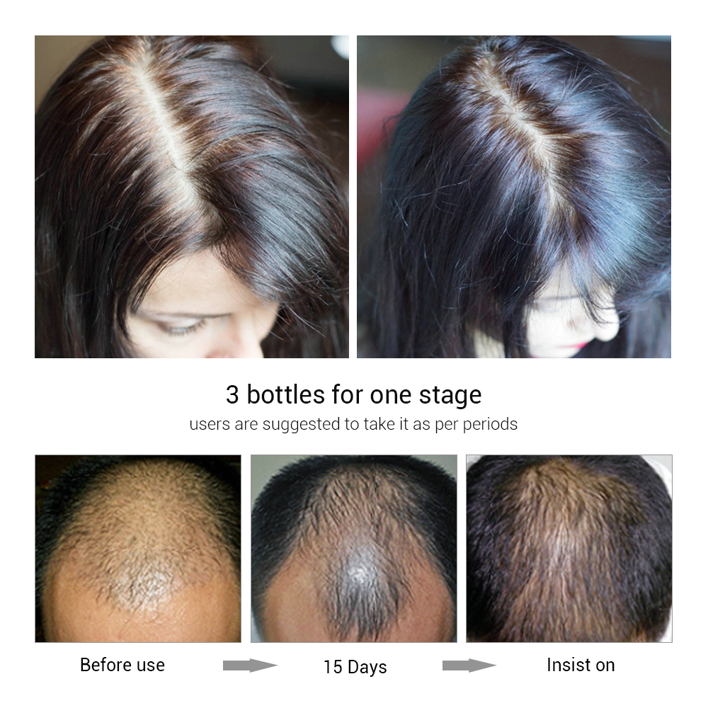 Lanbena hair growth essential oil (20ml) Image 3