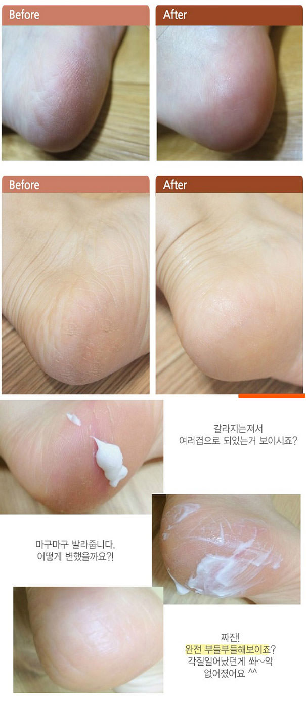 3W CLINIC Enrich Lovely Foot Cream, 150ml Image 1